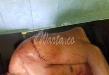 Korban luka bacok (Slamet) orang tua pelaku