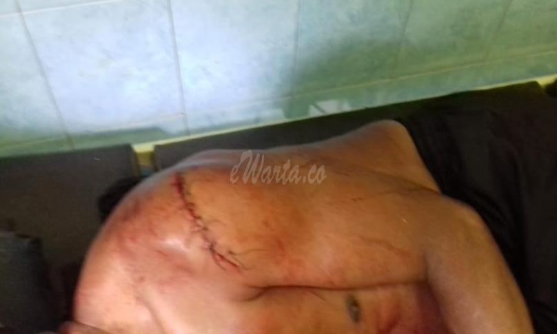 Korban luka bacok (Slamet) orang tua pelaku