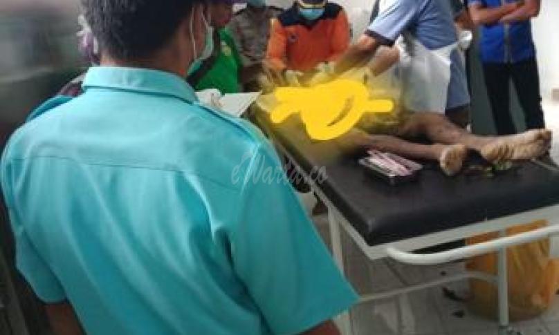 Korban saat dilakukan autopsi 