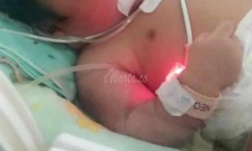 Bayi Penderita Jantung