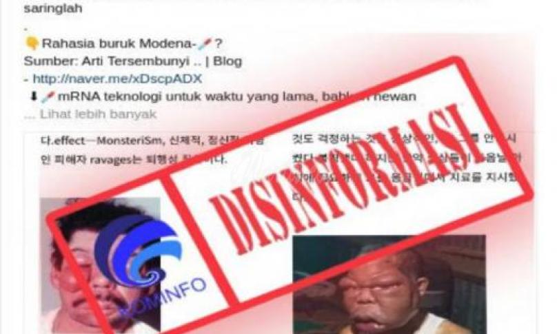 Awas!! Hoax Wajah Bengkak Akibat Efek Samping Vaksin Moderna
