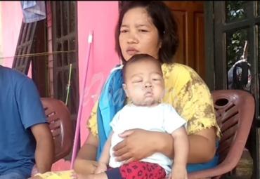 Dengan penuh harap orang tua Correlio bisa memberikan pengobatan yamg terbaik bagi anaknya.